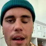 Justin Bieber compartió un vídeo en el que mostraba los efectos del virus en su cara