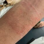Heridas causadas por el robo de un reloj En Les Corts