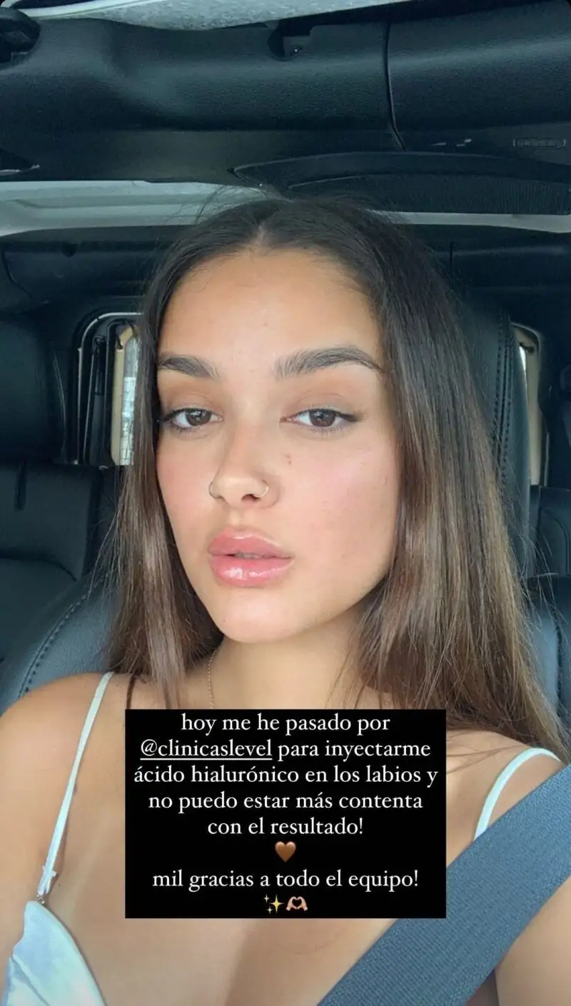 Julia Janeiro muestra su aumento de labios