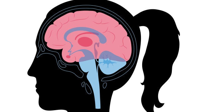 Las mujeres después de la menopausia tienen más lesiones pequeñas en el cerebro que los hombres