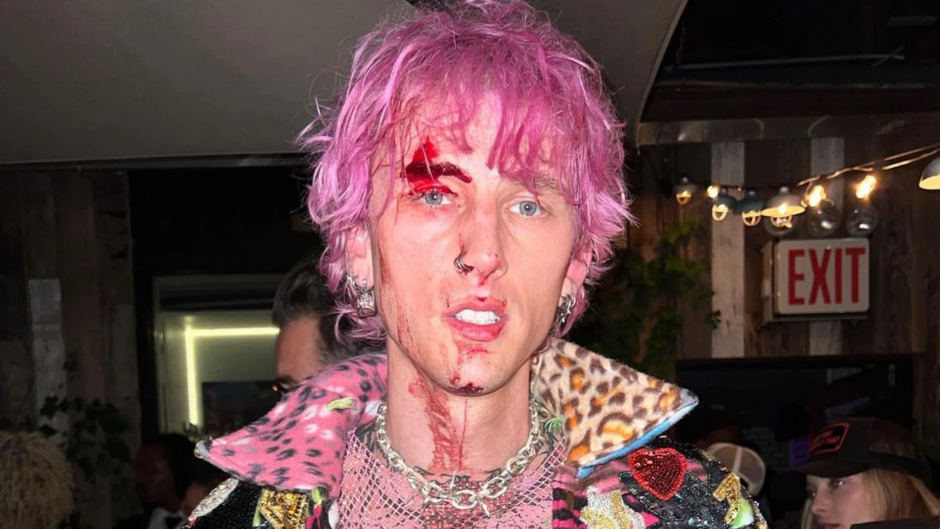 Machine Gun Kelly cubierto de sangre