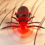 Guía para el manejo de las picaduras en verano