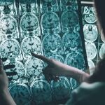 Resonancia magnética de una persona con Alzheimer