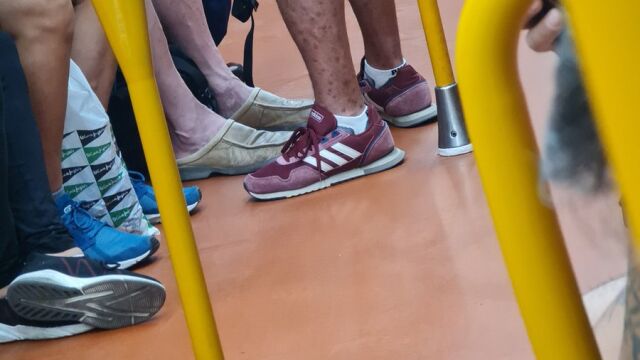 Fotografía de un contagiado de viruela del mono en el Metro de Madrid