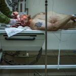 Médicos atienden a soldados ucranianos heridos en Zaporiyia