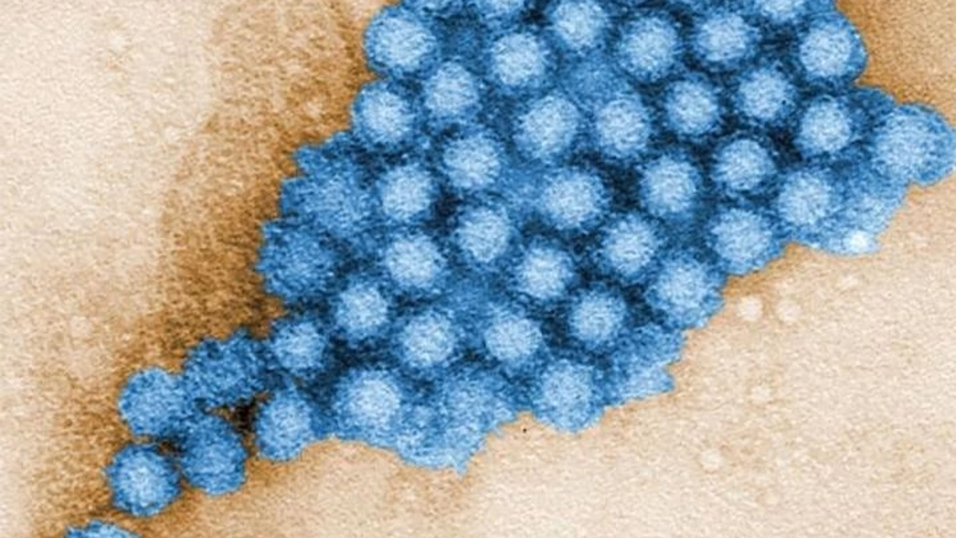Los microbios intestinales pueden reducir o aumentar la gravedad de la infección por norovirus en función del lugar a lo largo del intestino donde se asiente el virus