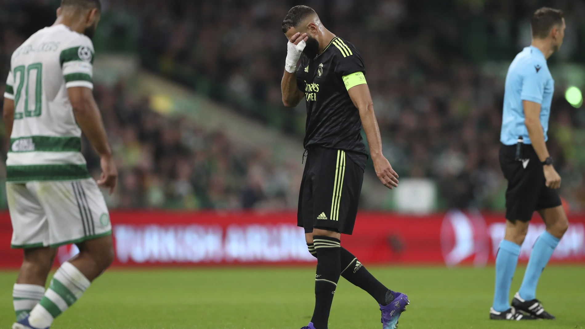Karim Benzema sale lesionado en el Celtic-Real Madrid