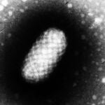 Virus de Orf visto al microscopio electrónico (Graham Beards)