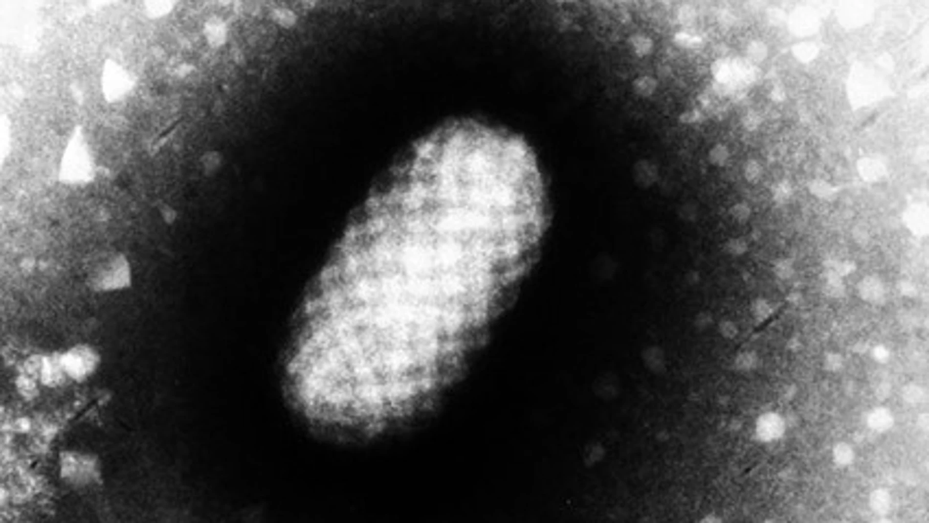 Virus de Orf visto al microscopio electrónico (Graham Beards)