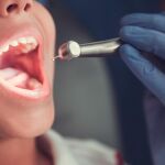 Todos los partidos están de acuerdo en incluir la salud bucodental en la Cartera de Servicios del Sistema Nacional de Salud (SNS)