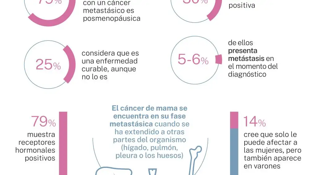 Cáncer de mama