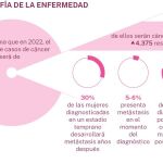 Radiografía del cáncer de mama