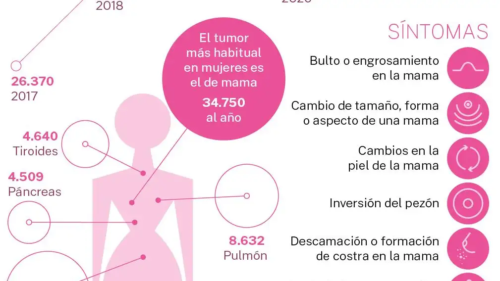 Radiografía del cáncer de mama