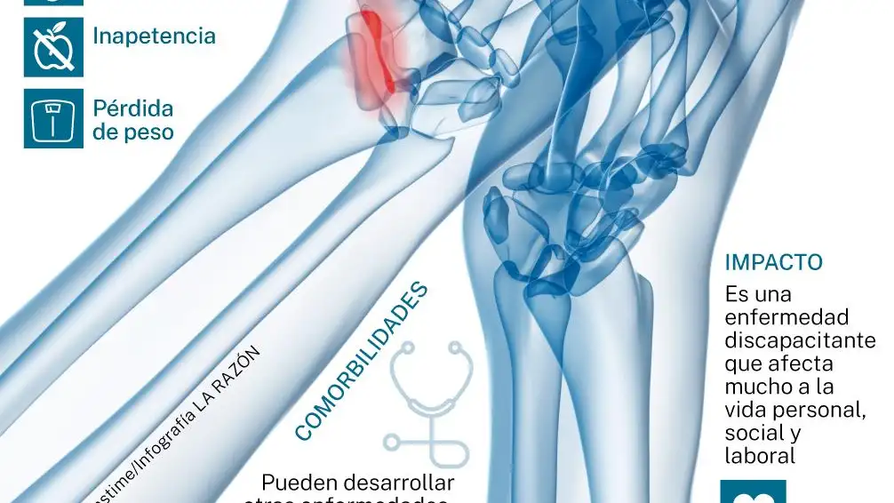 Radiografía de la enfermedad