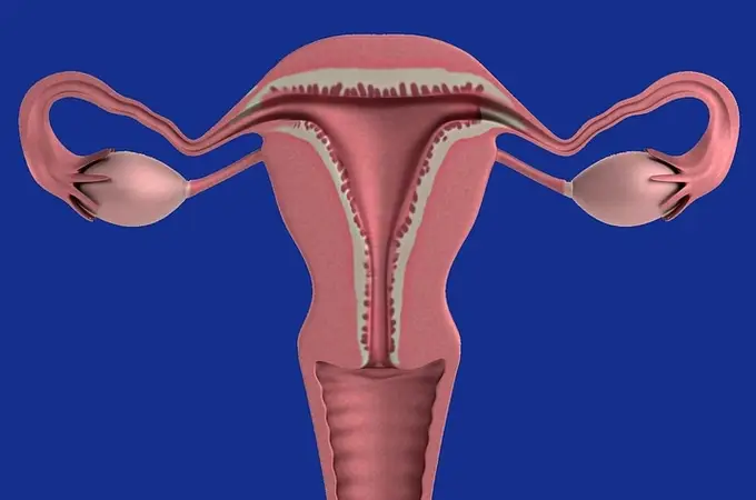 La extirpación quirúrgica de los ovarios acelera el envejecimiento y la demencia