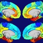 Las áreas rojas y naranjas de estos mapas de calor de cerebros humanos muestran dónde está más activo el gen APOE (dos imágenes cerebrales superiores) y dónde se concentran los ovillos de la proteína tau (dos imágenes cerebrales inferiores).