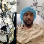 Yasser Al-Shahrani junto a la imnpactante imagen de su radiografía