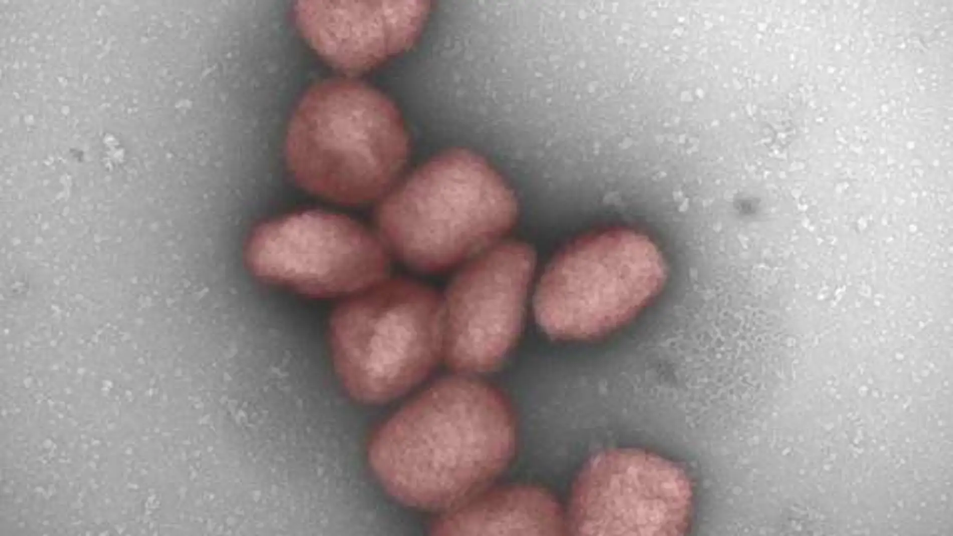 Partículas del virus de la viruela del mono teñidas de rojo