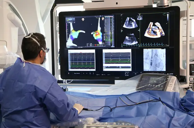 Vall d’Hebron crea una sonda 4D única en el mundo para operar cardiopatías en bebés