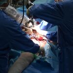 El equipo quirúrgico coordinado por el jefe del Servicio de Cirugía Ortopédica y Traumatología del Hospital Clínico Universitario de Valladolid, David Noriega, ha culminado con éxito las primeras intervenciones llevadas a cabo con la nueva plataforma robótica especializada en la realización de artroplastias de cadera y rodilla