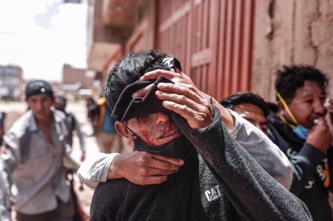 17 muertos por heridas de bala en Perú: ¿qué está pasando y qué piden los manifestantes?