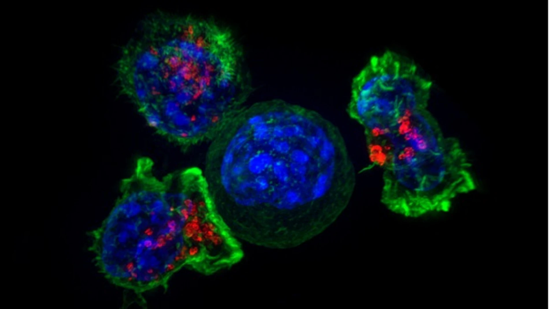 Las biocápsulas favorecerán la implantación y diseminación de las células inmunitarias en los tumores o en la región operada tras ser extirpados