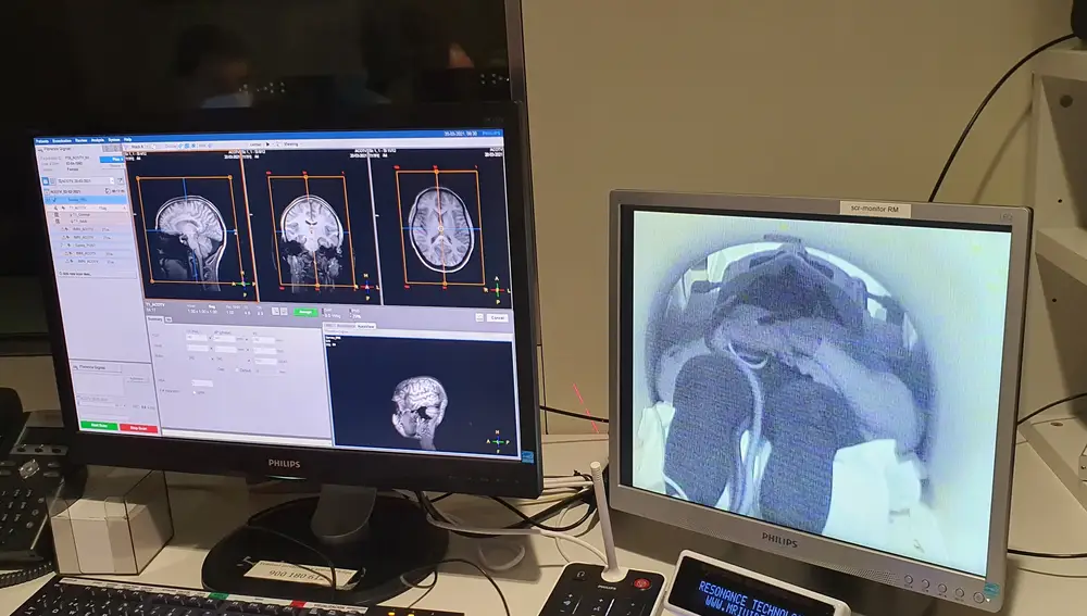 Las pruebas realizadas a los participantes en el estudio han dado como resultado imágenes que han permitido observar los cambios en la conectividad cerebral