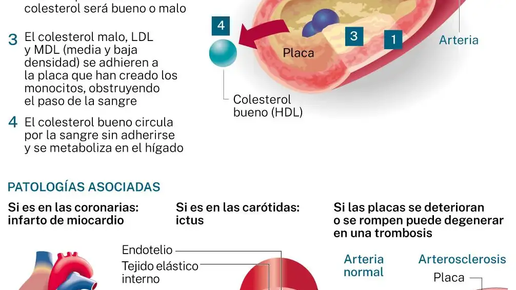 Radiografía del colesterol