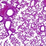 Pulmones de ratón con píldora viva activa combatiendo P. aeruginosa (1)