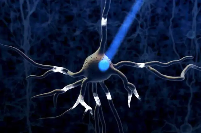 Implantan neuronas en pacientes con Parkinson