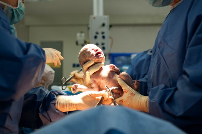 Bebé recién nacido en un parto por cesárea