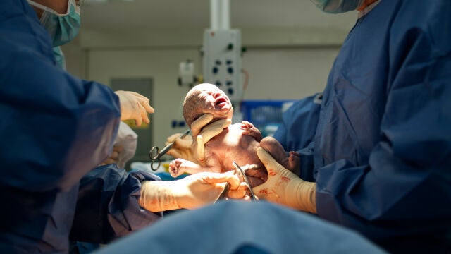 Bebé recién nacido en un parto por cesárea
