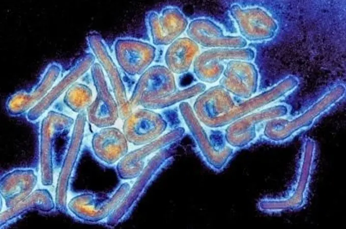 Qué es el virus del ébola, qué síntomas provoca y cómo se contagia