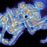 Guinea Ec.- Guinea Ecuatorial declara la alerta sanitaria tras confirmar un brote de virus de Marburgo, similar al ébola