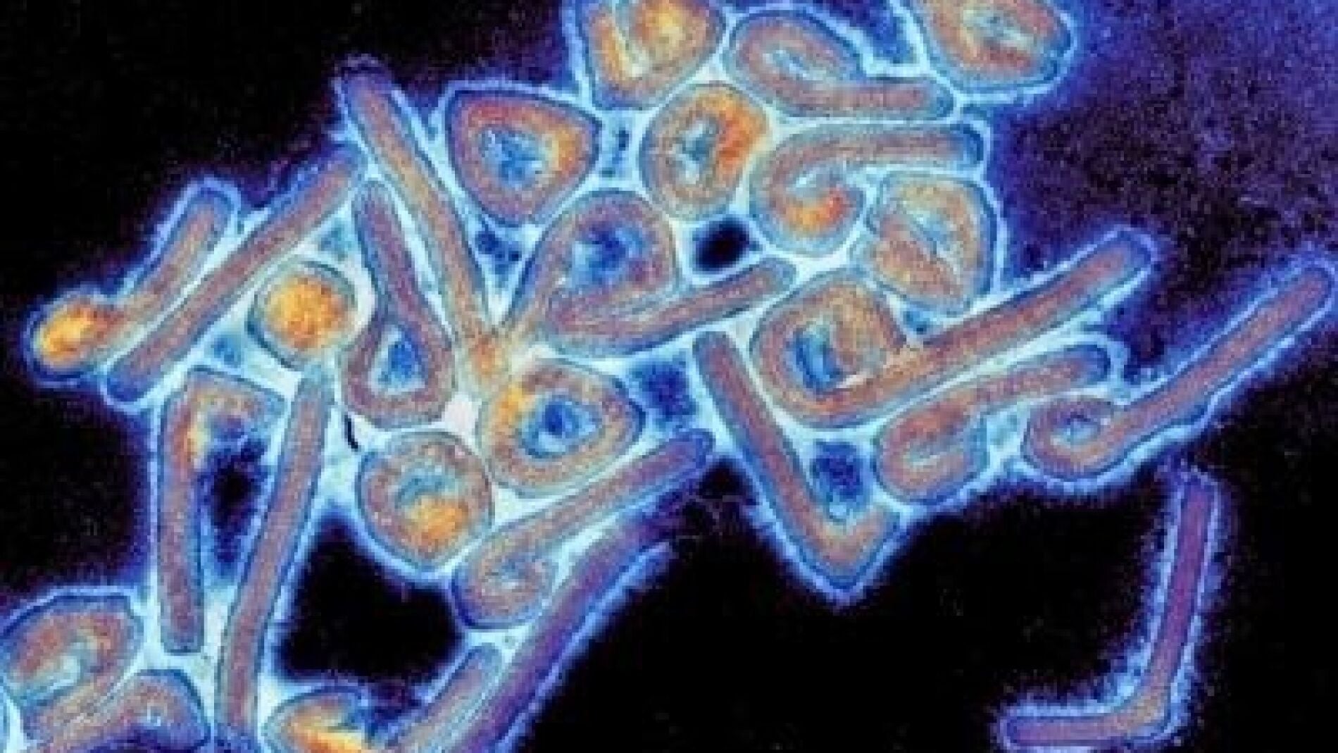 Qué es el virus del ébola, qué síntomas provoca y cómo se contagia