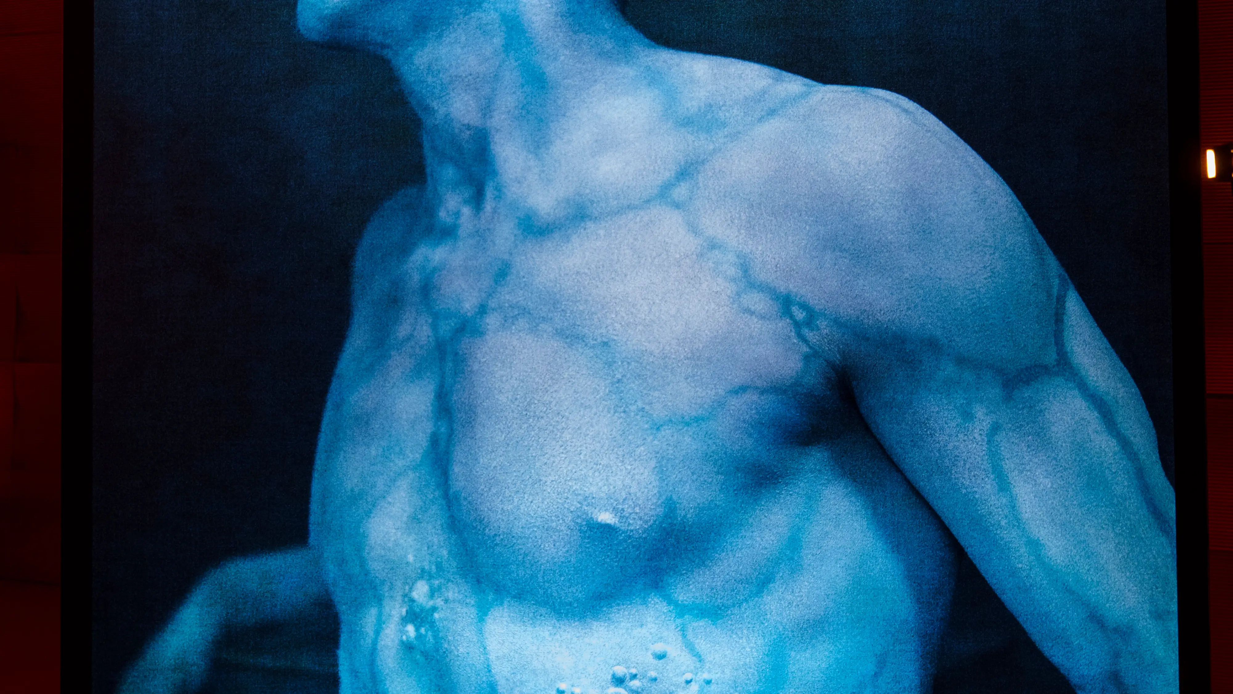 Del 3 al 5 de marzo, coincidiendo con la Semana Mundial del Herpes Zóster, tendrá lugar una exposición fotográfica sobre el Herpes Zóster de la mano del artista y fotógrafo Eugenio Recuenco, donde daremos forma, luz y color a esta patología