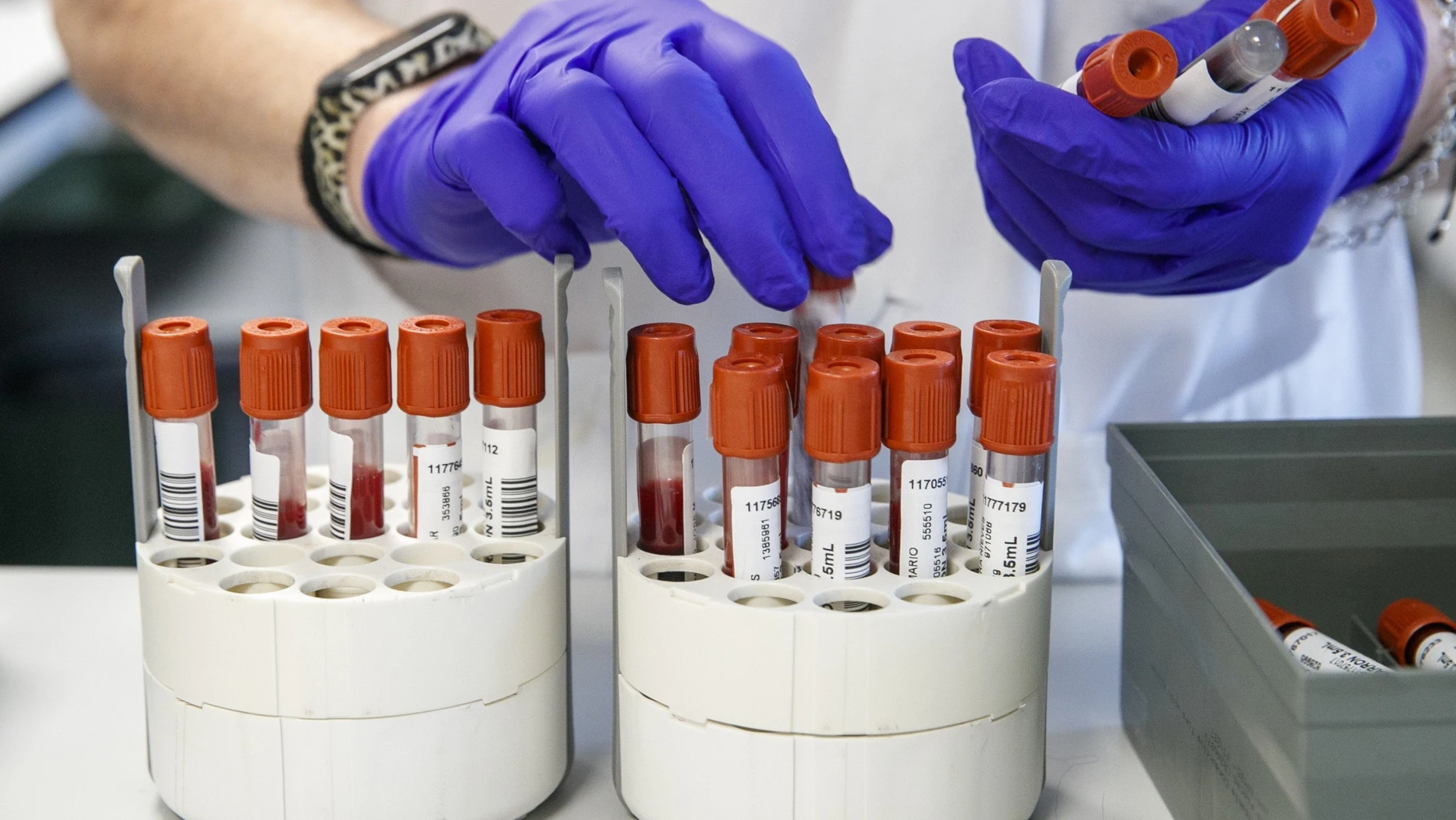 Un técnico de laboratorio prepara unas muestras de sangre para analizar 