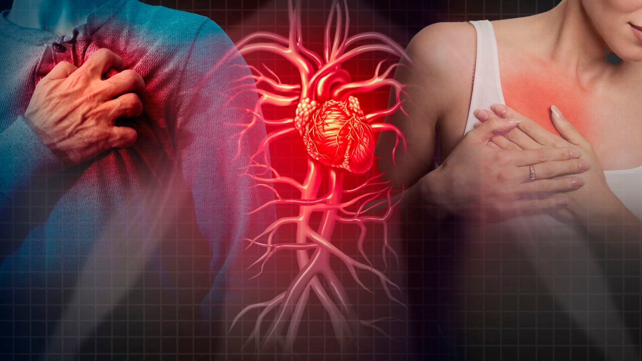 Sufrir un infarto aumenta el riesgo de padecer otras enfermedades graves