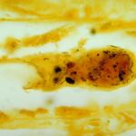 Muestra de tejido renal que muestra la bacteria que causa leptospirosis