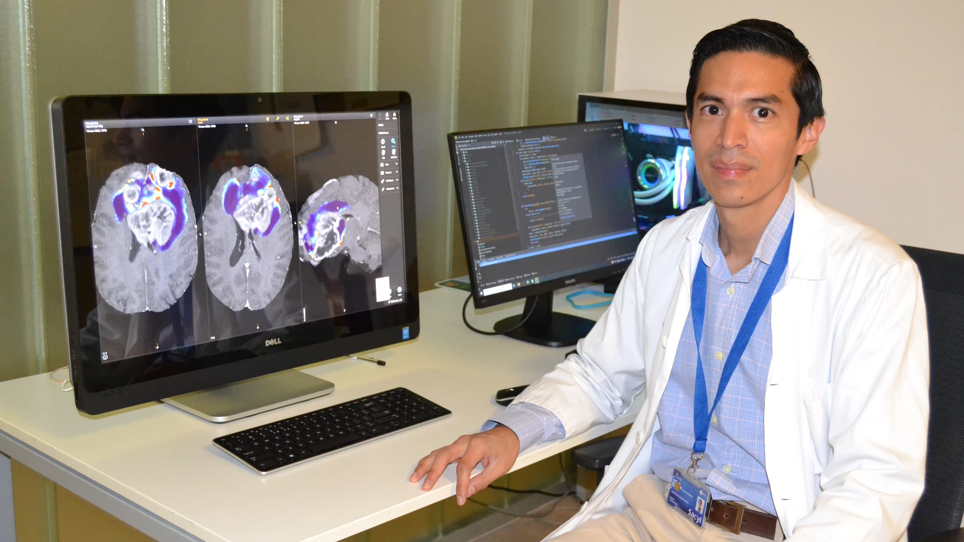 El doctor Santiago Cepeda lidera una investigación basada en la inteligencia artificial contra este tumor cerebral letal