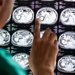 doctor-que-lee-resultado-radiografia-resonancia-magnetica-cerebro