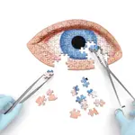 Cirugía ocular