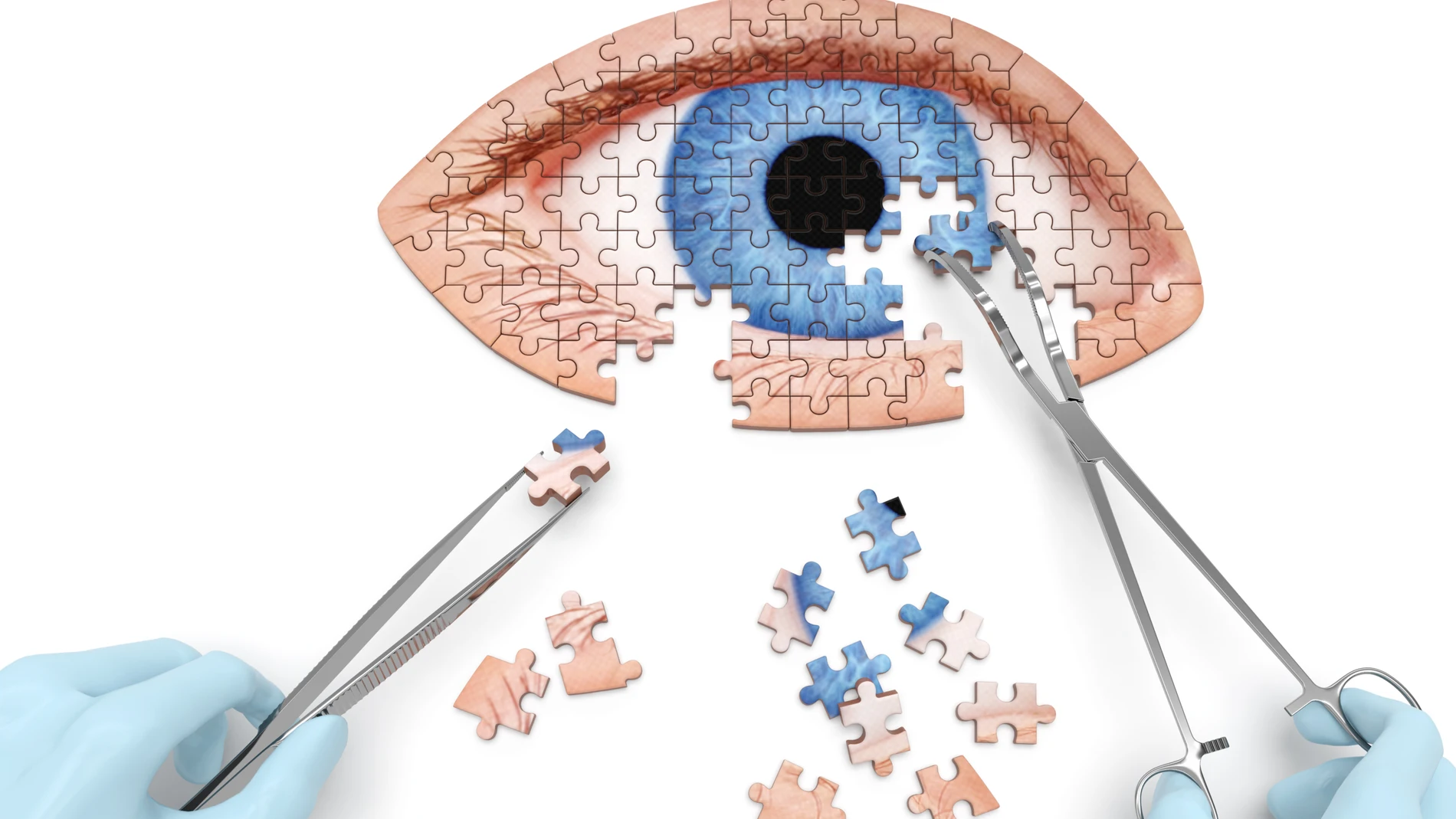 Cirugía ocular