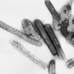 El caso sospechoso de fiebre hemorrágica en Cantabria da negativo en Marburgo, Ébola y Lassa