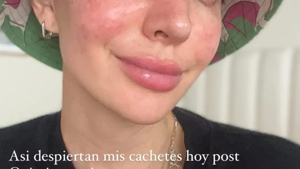 Story de Aylén Milla