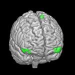 La región cerebral del frontal inferior y la de la corteza orbitofrontal lateral desarrollan un mayor volumen en función de la duración de la lactancia materna 