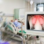Human coronavirus lung Inflammation and infection show on screen in hospital patients.