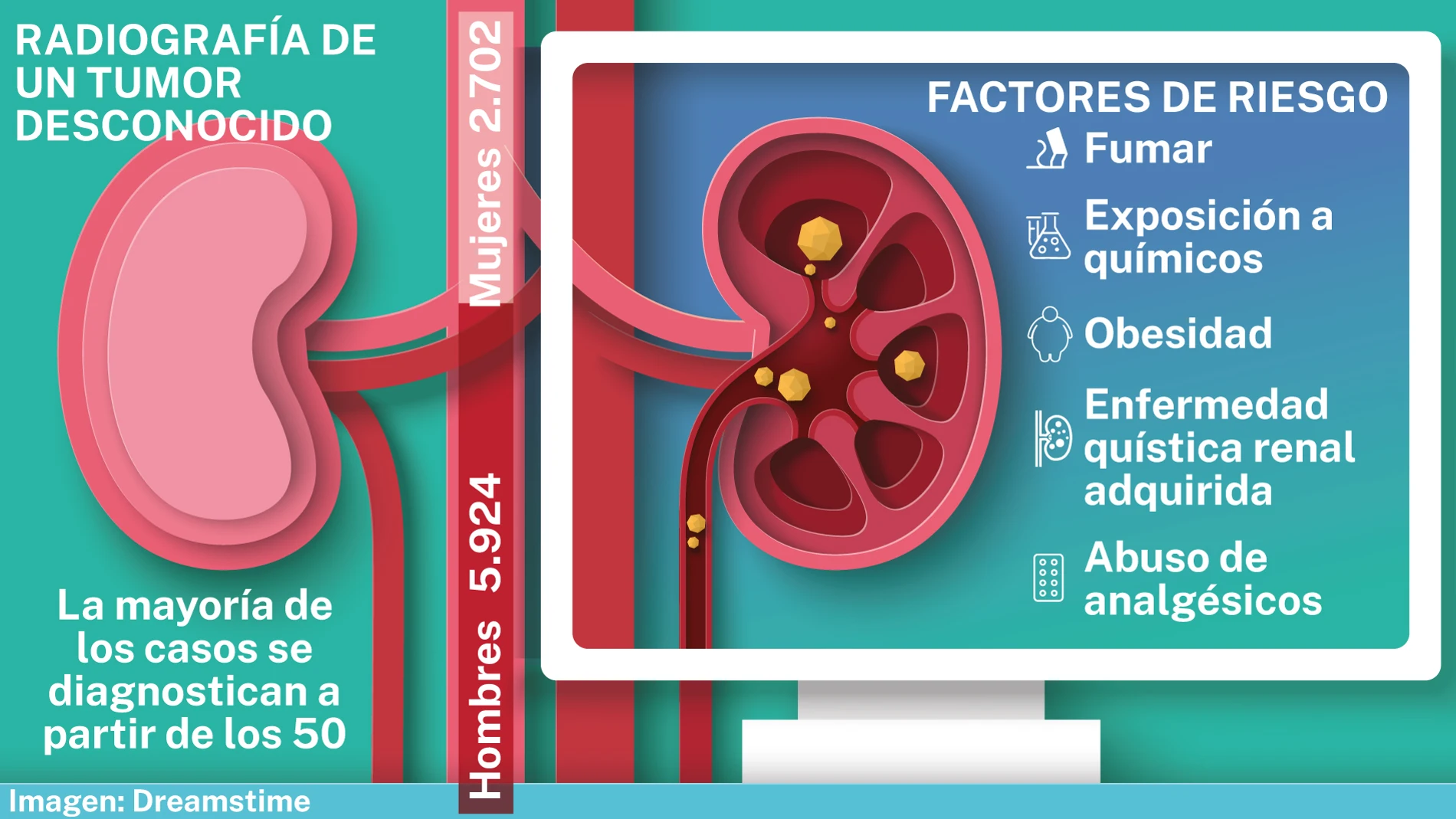 Tumor de riñón