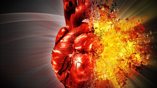 Enfermedades cardiovasculares