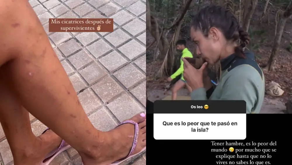 Adara confesando las secuelas que padece después de 'Supervivientes'